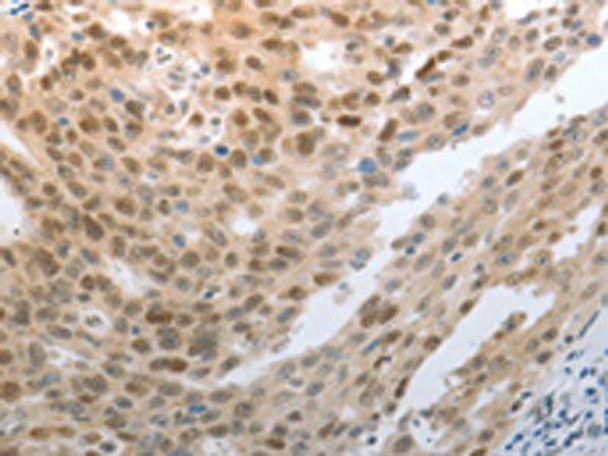 SLC22A8 Antibody (PACO18792)