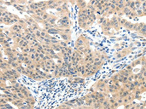 SLC20A1 Antibody (PACO18895)