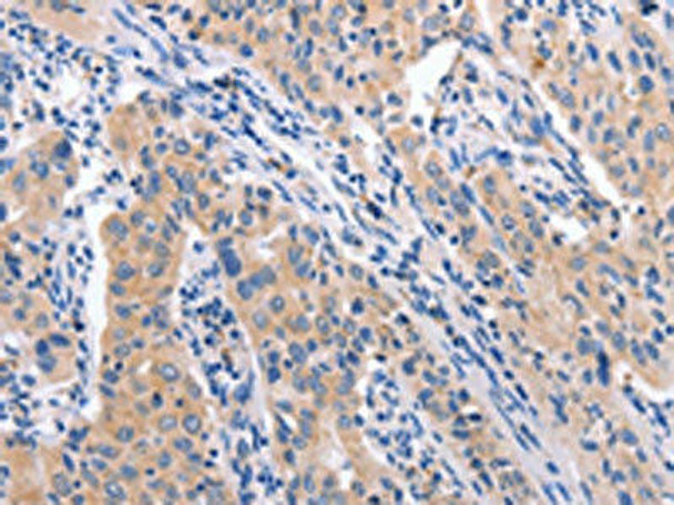 CCL23 Antibody (PACO19402)