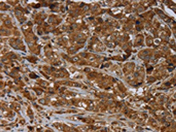 ARHGEF12 Antibody (PACO19922)