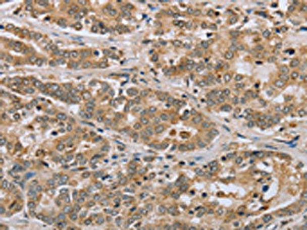 CLEC16A Antibody (PACO20101)