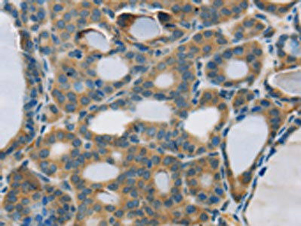 RPS6KA2 Antibody (PACO20369)