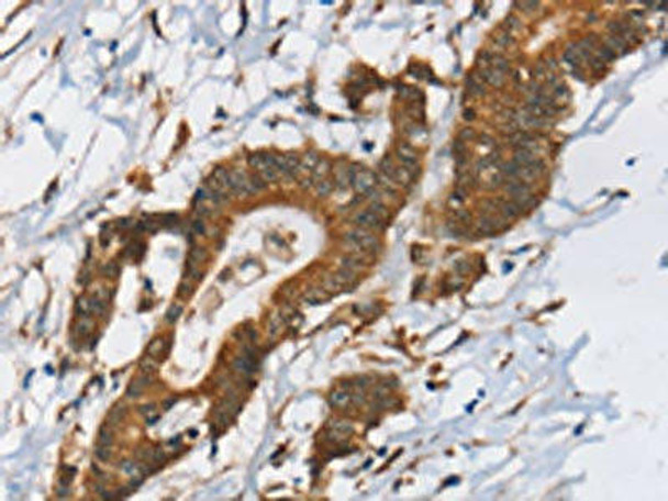 RPS6KA2 Antibody (PACO20370)