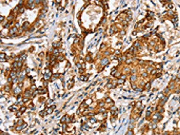 SLC5A11 Antibody (PACO20520)