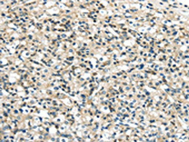 VPS26A Antibody (PACO20865)