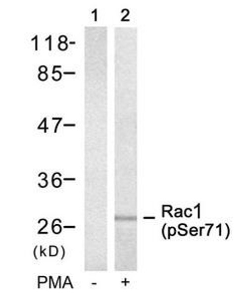 Phospho-RAC1 (Ser71) Antibody (PACO23867)