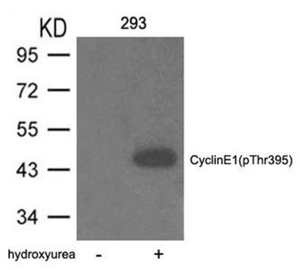 Phospho-CCNE1 (Thr395) Antibody (PACO23907)