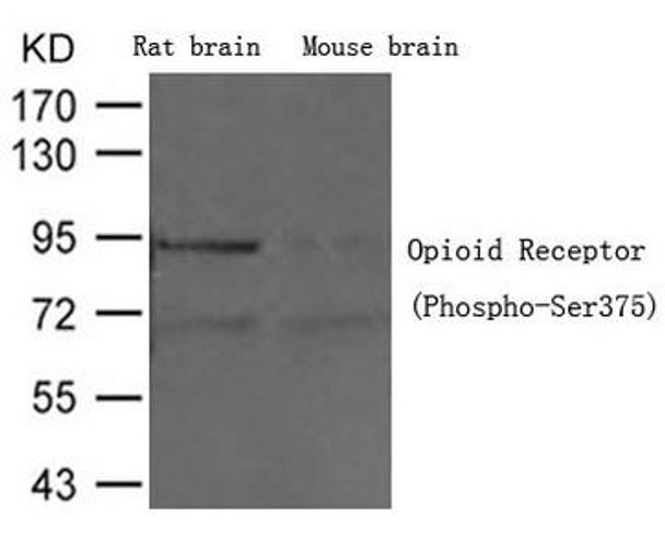 Phospho-OPRM1 (Ser375) Antibody (PACO23924)