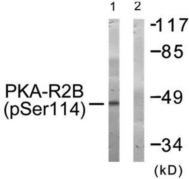 Phospho-PRKAR2B (Ser113) Antibody (PACO24094)