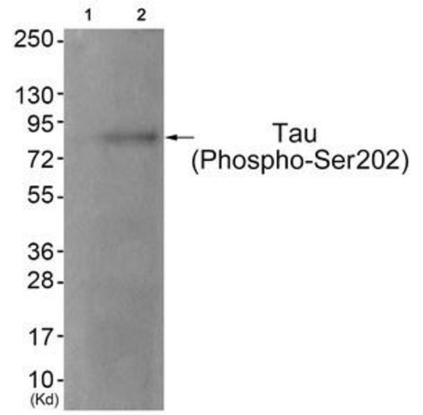 Phospho-MAPT (Ser202) Antibody (PACO24105)