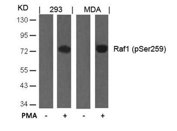 Phospho-RAF1 (Ser259) Antibody (PACO24223)
