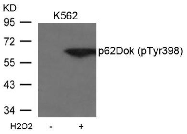 Phospho-DOK1 (Tyr398) Antibody (PACO24320)