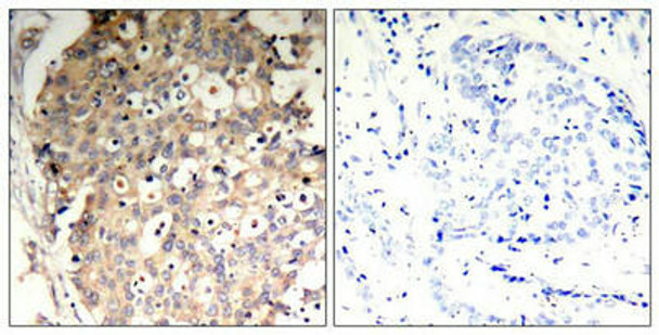 Phospho-PTPN6 (Tyr536) Antibody (PACO24331)