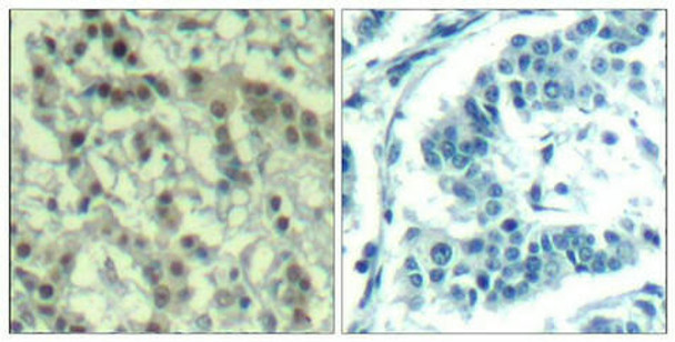 Phospho-AURKA (Thr288) Antibody (PACO24340)