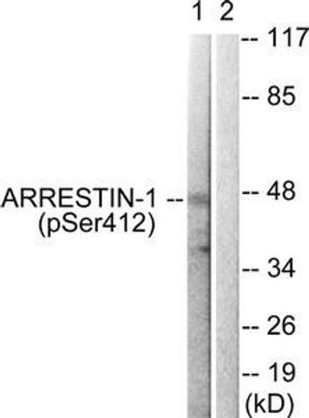 Phospho-ARRB1 (Ser412) Antibody (PACO24369)