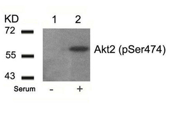 Phospho-AKT2 (Ser474) Antibody (PACO24462)