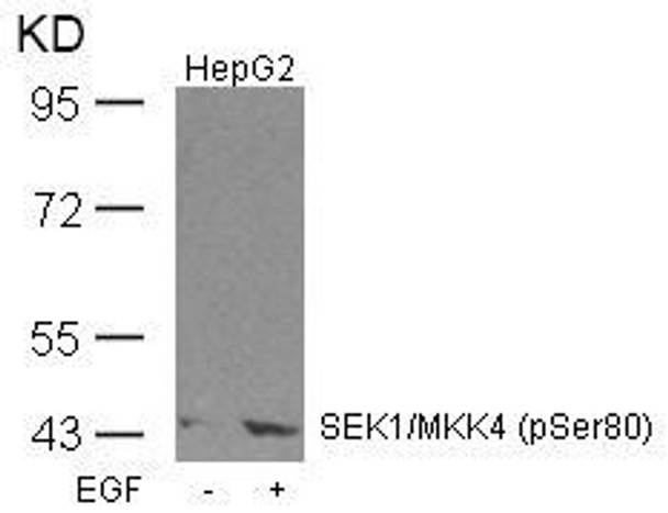 Phospho-MAP2K4 (Ser80) Antibody (PACO24476)