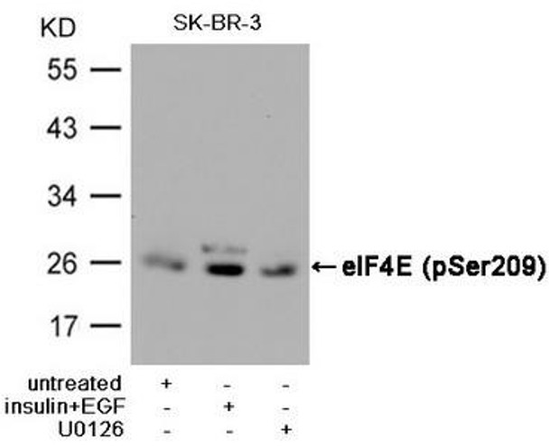 Phospho-EIF4E (Ser209) Antibody (PACO24482)
