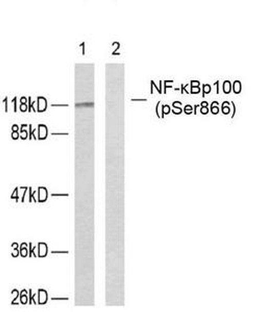 Phospho-NFKB2 (Ser866) Antibody (PACO24519)