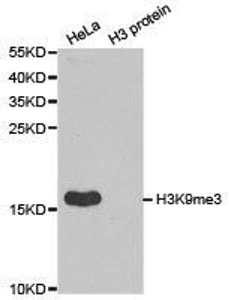 Histone H3K9me3 Antibody (PACO24597)