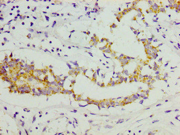 COL11A1 Antibody (PACO25849)