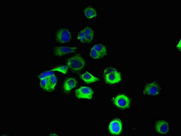 RNF103 Antibody (PACO29532)