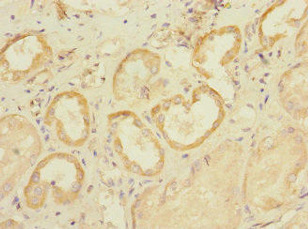 SLC28A1 Antibody (PACO29940)