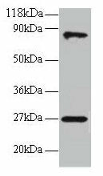 RPL17 Antibody (PACO30830)