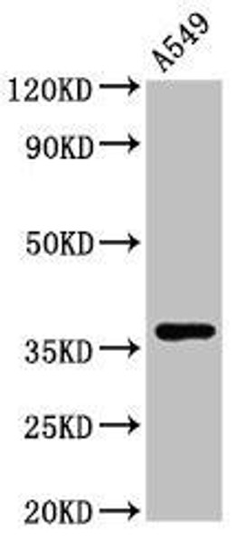 ZNF488 Antibody (PACO31336)