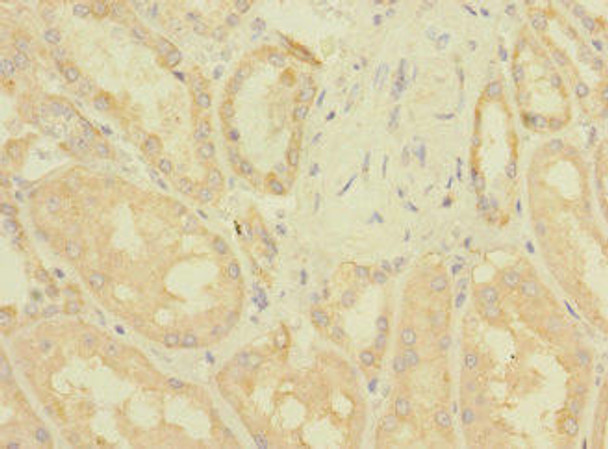 ZNF624 Antibody (PACO31432)