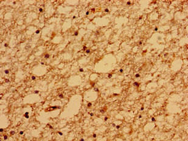 TMEM67 Antibody (PACO36178)