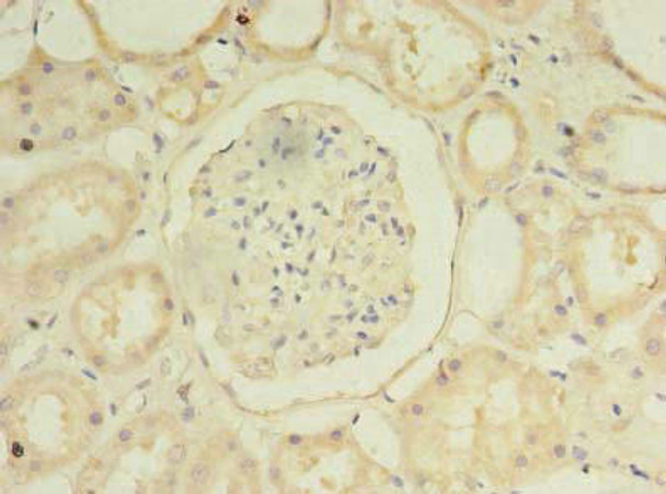 MFSD14B Antibody (PACO36318)