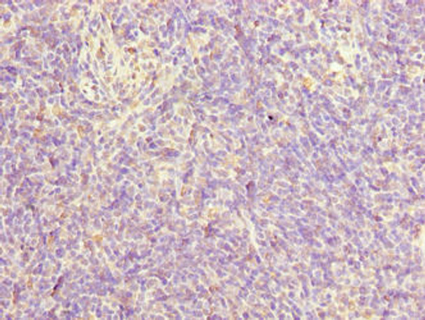 FAM124A Antibody (PACO37518)