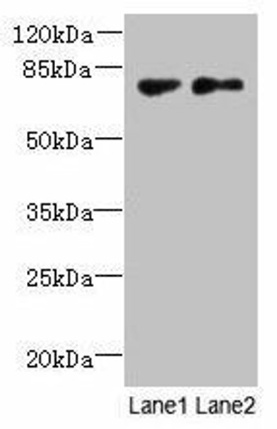 TTC30B Antibody (PACO37930)