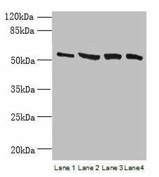 CCDC112 Antibody (PACO37982)
