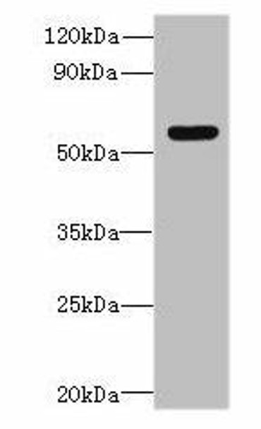 SLC35F5 Antibody (PACO38862)