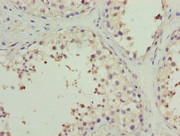 PPP1R14A Antibody (PACO39530)