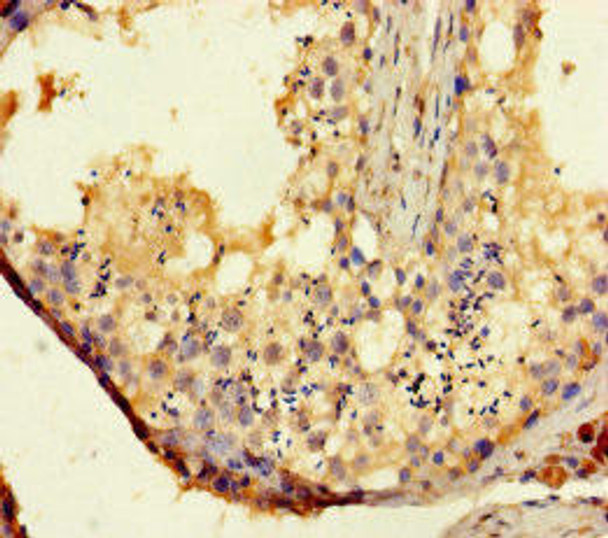 TAS2R14 Antibody (PACO40914)