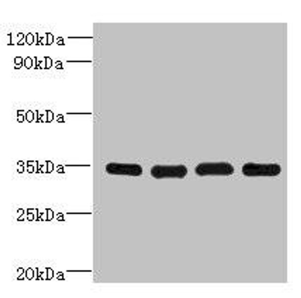 DNAJC17 Antibody (PACO41182)