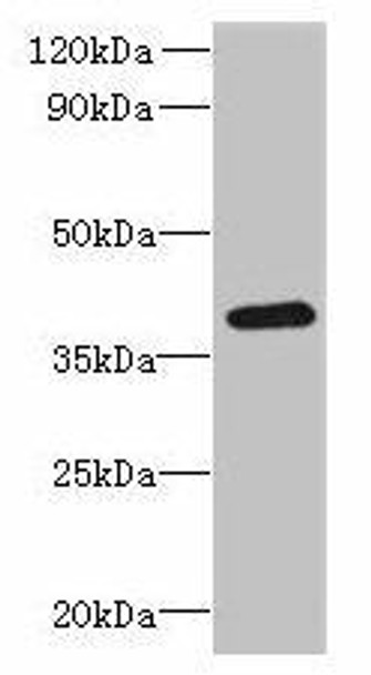 RSPH14 Antibody (PACO42058)