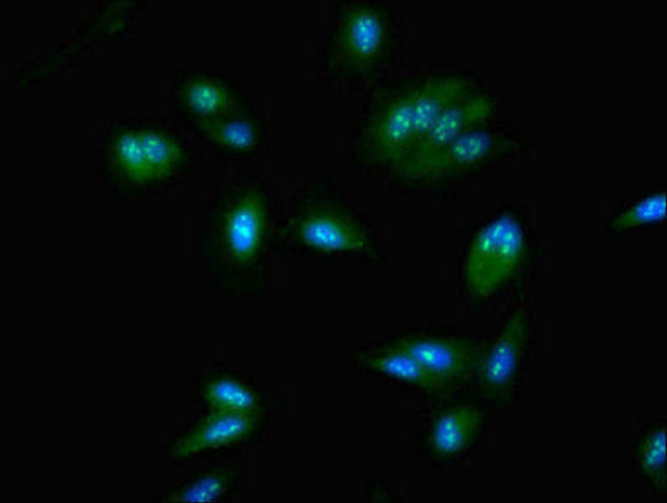 NOP58 Antibody (PACO42658)