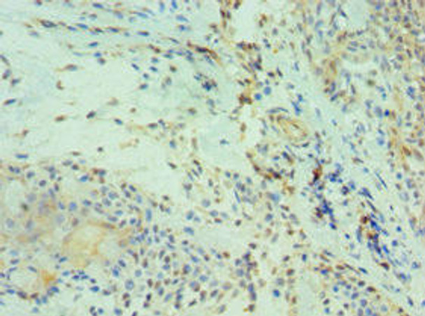 CDH13 Antibody (PACO43218)