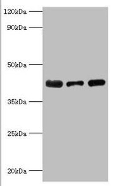 ST8SIA2 Antibody (PACO43644)