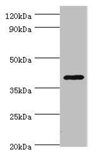 HDAC11 Antibody (PACO43743)