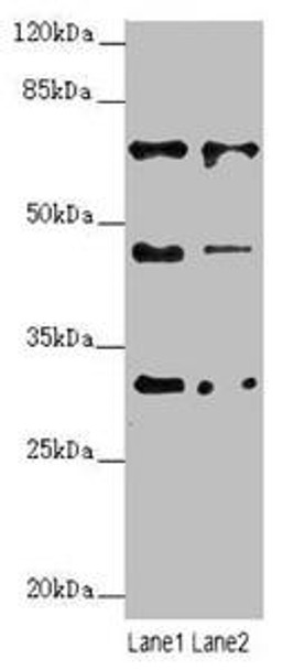 ZNF785 Antibody (PACO44702)