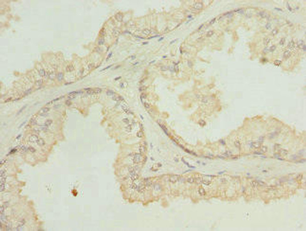 SH3GLB2 Antibody (PACO44800)