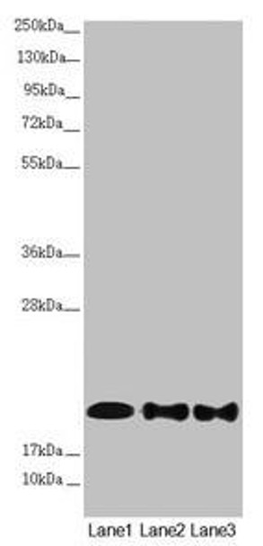 NDUFB10 Antibody (PACO45189)