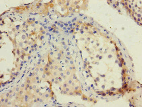 TRIP12 Antibody (PACO45278)