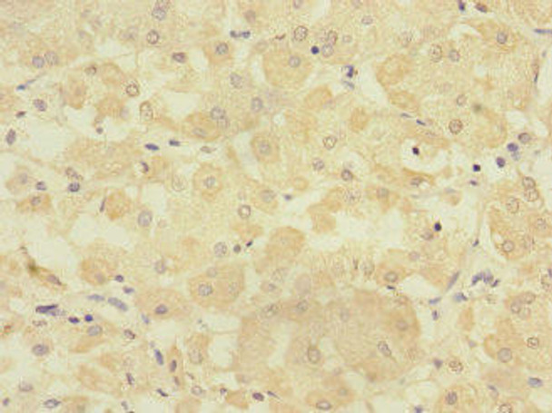 TMPRSS15 Antibody (PACO45375)