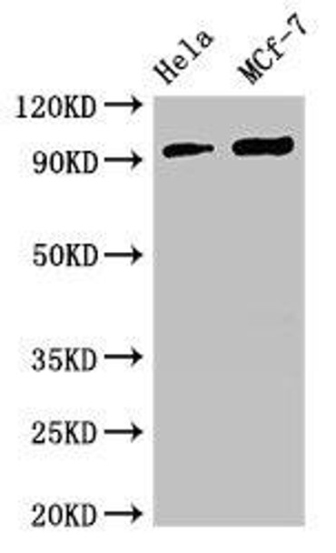 TTC27 Antibody (PACO50686)